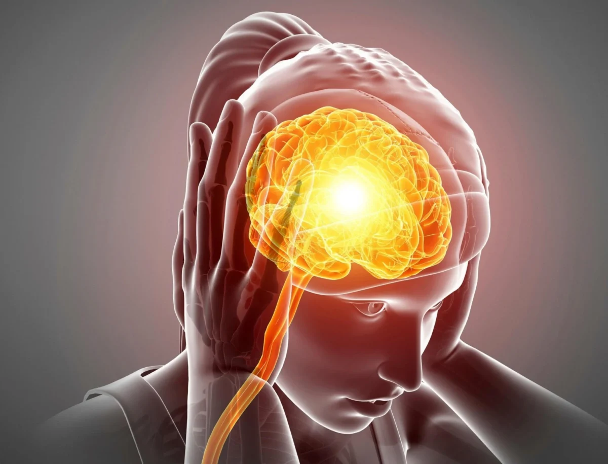 کاهش قابل توجه سردردهای میگرنی با استفاده از داروی لاغری لیراگلوتاید