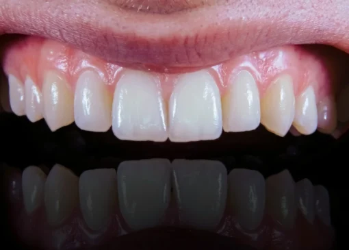 نقش چشمگیر رژیم مدیترانه‌ای در پیشگیری از بیماری‌ های لثه