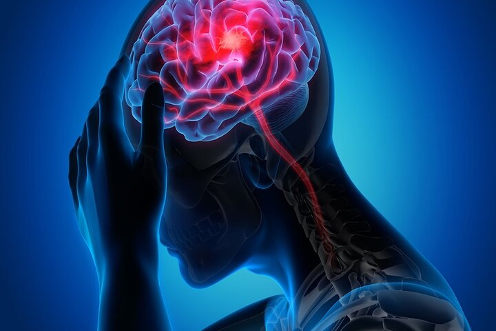تایید ارتباط عجیب برداشتن رحم با سکته مغزی | بازتاب امروز