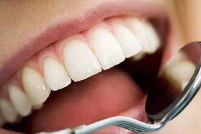 چند توصیه مهم برای سلامت دهان و دندان در روزه داری | بازتاب امروز