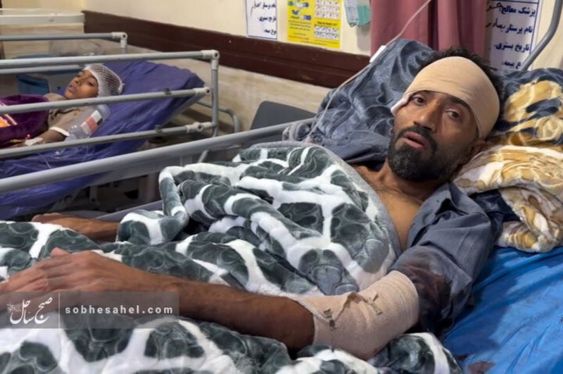 هنرمند اهل سیریک در جریان حمله آمریکا در سیریک مجروح شد | بازتاب امروز